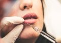 Chirurgie esthétique