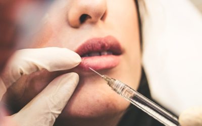 Chirurgie esthétique