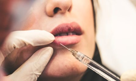 Chirurgie esthétique
